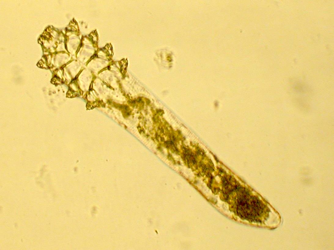 Mites in Your Eyelashes? FDA Approves First-Ever Treatment for Demodex Blepharitis